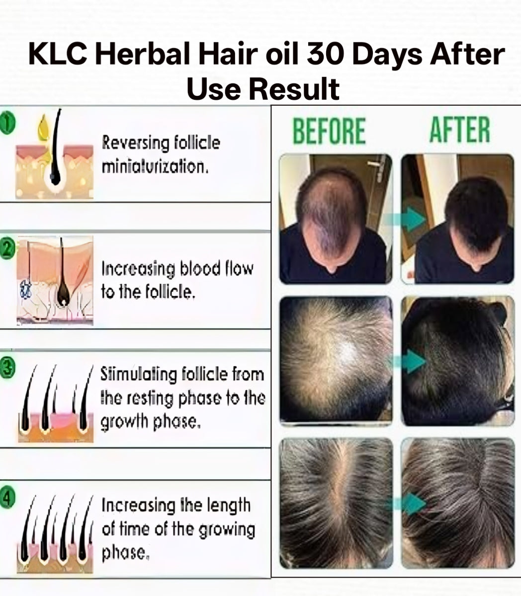 KLC Next Herbal Hair Oil with Bhringraj, Amla & Onion – For Strong & Healthy Hair (200ml)